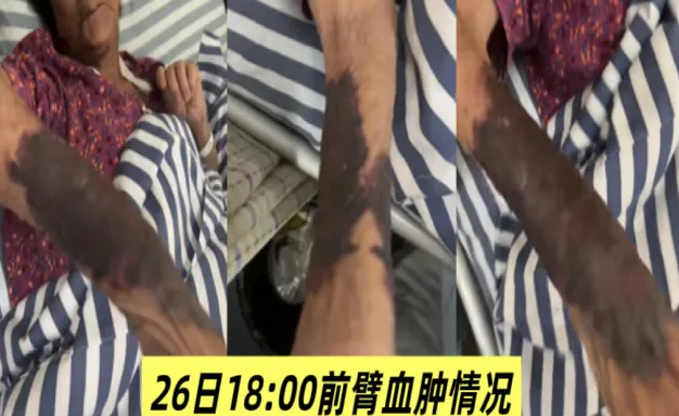 省級專家線上解難題，邵陽市中心醫(yī)院遠程護理會診再啟動