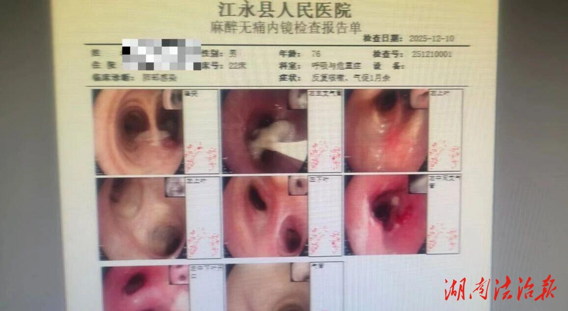 【医疗服务提升年】七旬老人咳喘月余，元凶竟是气道骨头！江永县人民医院呼吸科医生镜下精准“揪出”