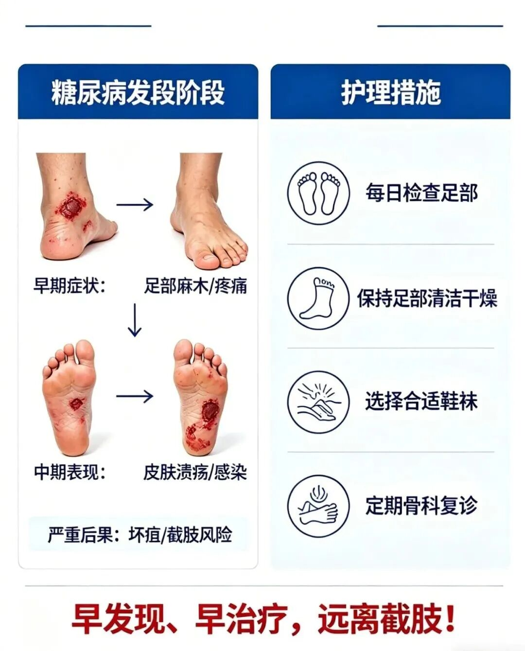 市中心医院：糖尿病足不拖延 骨科护理教你远离截肢风险